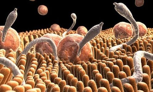 Как выглядят черви в организме человека