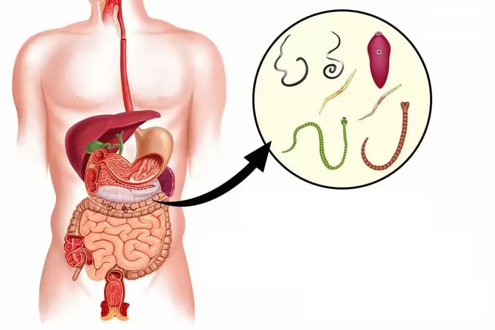 Паразиты в кишечнике человека